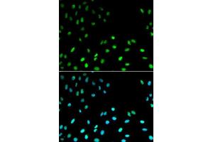 Immunofluorescence analysis of MCF-7 cells using RFC1 antibody. (RFC1 antibody  (AA 400-700))