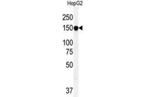 ABCC10 Antibody (ABCC10 antibody  (Middle Region))