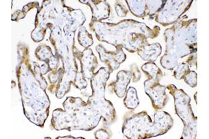 IHC analysis of Cyclophilin B using anti-Cyclophilin B antibody . (PPIB antibody  (AA 158-216))