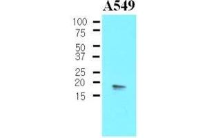 The Cell lysates of A549 (30 ug) were resolved by SDS-PAGE, transferred to nitrocellulose membrane and probed with anti-human PPP1R14A (1:500). (CPI-17 antibody  (AA 1-147))
