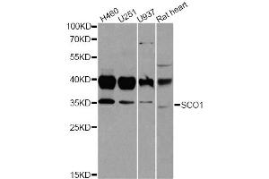Western blot analysis of extracts of various cell lines, using SCO1 antibody (ABIN2559843) at 1:1000 dilution. (SCO1 antibody)