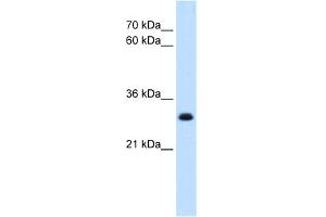 WB Suggested Anti-TAL1 Antibody   Titration: 5 ug/ml   Positive Control: HepG2 Whole Cell (TAL1 antibody  (Middle Region))