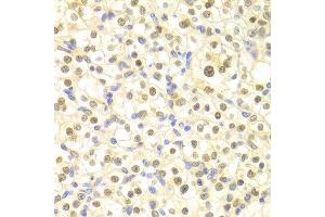 Immunohistochemistry (IHC) image for anti-Damage-Specific DNA Binding Protein 2, 48kDa (DDB2) (AA 1-315) antibody (ABIN3022632) (DDB2 antibody  (AA 1-315))