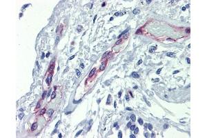 EHD4 antibody was used for immunohistochemistry at a concentration of 4-8 ug/ml. (EHD4 antibody  (Middle Region))