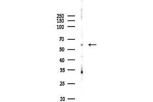 Western blot analysis of lysates from Hela cells(heat-shock 45 min treatment), using BIRC2 Antibody at 1/1000 dilution.
