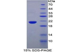 SDS-PAGE (SDS) image for Ubiquitin D (UBD) (AA 1-155) protein (His tag) (ABIN1879676) (UBD Protein (AA 1-155) (His tag))