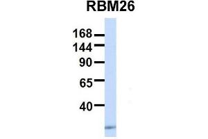 Host:  Rabbit  Target Name:  RBM26  Sample Type:  Human 293T  Antibody Dilution:  1. (RBM26 antibody  (Middle Region))