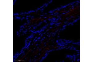 Immunofluorescence of paraffin embedded human prostate using paldadin (ABIN7074976) at dilution of 1: 500 (300x lens) (PALLD antibody)