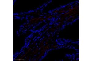 Immunofluorescence of paraffin embedded human prostate using paldadin (ABIN7074976) at dilution of 1: 500 (300x lens)