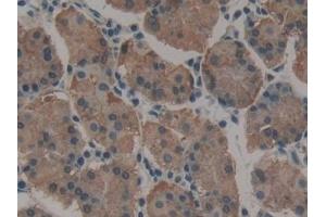 Immunohistochemistry (IHC) image for anti-Myosin, Heavy Polypeptide 10, Non-Muscle (MYH10) (AA 438-716) antibody (ABIN7435520)