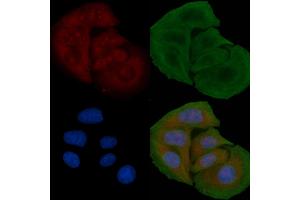 ABIN6259321 and ABIN6274774 staining Hela cells by IF/ICC. (RPL26L antibody  (C-Term))