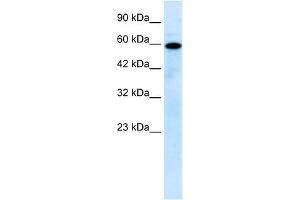 Mucolipin 1 antibody used at 0. (MCOLN1 antibody  (N-Term))