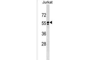 SPAM1 antibody  (C-Term)