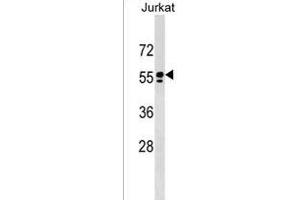 SM1 Antibody (C-term)  western blot analysis in Jurkat cell line lysates (35 μg/lane). (SPAM1 antibody  (C-Term))