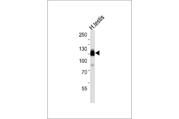 CABYR antibody