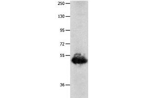 Western Blot analysis of Human lung cancer tissue using BPIFB3 Polyclonal Antibody at dilution of 1:1600 (BPIFB3 antibody)