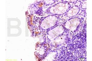 Formalin-fixed and paraffin embedded rat colitis labeled with Rabbit Anti SLC40A1 Polyclonal Antibody, Unconjugated (ABIN701095) at 1:200 followed by conjugation to the secondary antibody and DAB staining (SLC40A1 antibody)