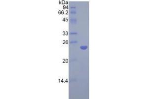 SDS-PAGE analysis of Rat COMT Protein.