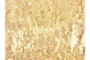 Immunohistochemistry of paraffin-embedded human adrenal gland tissue using ABIN7167753 at dilution of 1:100 (RTN4IP1 antibody  (AA 41-396))