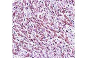Immunohistochemistry (IHC) image for anti-SMAD, Mothers Against DPP Homolog 3 (SMAD3) (AA 127-156) antibody (ABIN3032620)