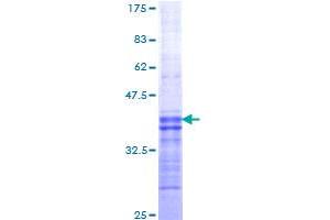 Image no. 1 for Hypocretin (Orexin) Receptor 2 (HCRTR2) (AA 1-54) protein (GST tag) (ABIN1306438) (HCRTR2 Protein (AA 1-54) (GST tag))