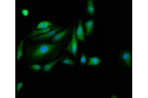 Immunofluorescence staining of Hela cells with ABIN7162684 at 1:200, counter-stained with DAPI. (PASK antibody  (AA 482-602))