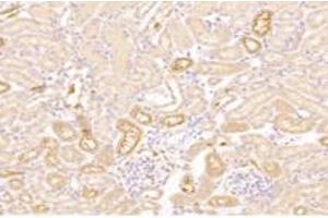Immunohistochemistry (Paraffin-embedded Sections) (IHC (p)) image for anti-Cathepsin L2 (CTSL2) antibody (ABIN7073348)