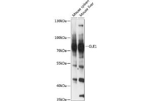 Western blot analysis of extracts of various cell lines, using GLE1 antibody (ABIN6131943, ABIN6141121, ABIN6141123 and ABIN6217118) at 1:3000 dilution. (GLE1 antibody  (AA 1-300))