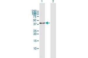 Western Blot analysis of SERPINB3 expression in transfected 293T cell line by SERPINB3 MaxPab polyclonal antibody.