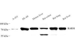Western blot analysis of RARS (ABIN7073119),at dilution of 1: 2000 (RARS antibody)