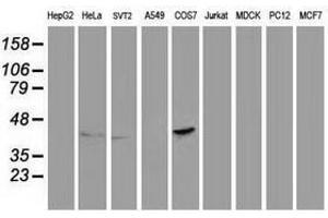 Image no. 5 for anti-Paraoxonase 1 (PON1) antibody (ABIN1500347) (PON1 antibody)