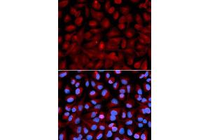 Immunofluorescence (IF) image for anti-Histone Deacetylase 6 (HDAC6) (AA 1-200) antibody (ABIN3022457)