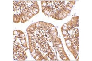 Immunohistochemistry of ZBP1 in human small intestine tissue with ZBP1 antibody at 2. (ZBP1 antibody  (C-Term))