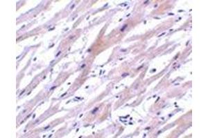 Immunohistochemistry of UNG1 in human heart tissue with this product at 2 μg/ml. (UNG antibody  (N-Term))