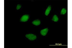 Immunofluorescence of purified MaxPab antibody to STK36 on HeLa cell. (STK36 antibody  (AA 1-1315))