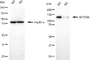 Western blotting analysis using NEDD4L antibody (ABIN7798419). (Recombinant NEDD4-2 antibody)