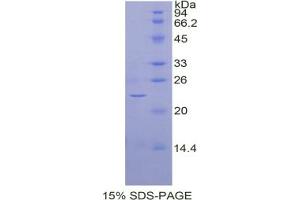 SDS-PAGE analysis of Cow BMP4 Protein. (BMP4 Protein)