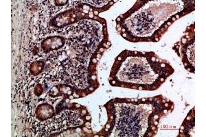 Immunohistochemical analysis of paraffin-embedded human-small-intestine, antibody was diluted at 1:200.
