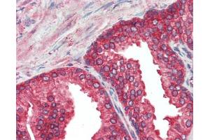 Human Prostate: Formalin-Fixed, Paraffin-Embedded (FFPE) (FAM120A antibody  (AA 1068-1118))