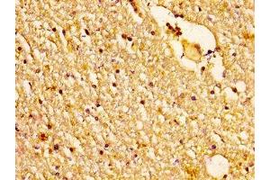 IHC image of ABIN7160954 diluted at 1:200 and staining in paraffin-embedded human brain tissue performed on a Leica BondTM system. (NDUFS2 antibody  (AA 297-427))