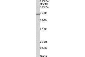 ABIN2560413 (2µg/ml) staining of Daudi lysate (35µg protein in RIPA buffer). (TICAM1 antibody)