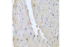 Immunohistochemistry of paraffin-embedded rat heart using DEFA1 antibody. (alpha Defensin 1 antibody  (AA 1-94))