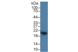 Rabbit Capture antibody from the kit in WB with Positive Control: Mouse cerebrum lysate.