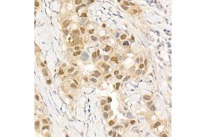Immunohistochemistry (IHC) image for anti-C-Abl Oncogene 1, Non-Receptor tyrosine Kinase (ABL1) (AA 490-590) antibody (ABIN3020872)