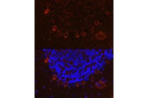 Immunofluorescence analysis of mouse brain cells using  Rabbit pAb (ABIN6131182, ABIN6136830, ABIN6136831 and ABIN6222940) at dilution of 1:100 (40x lens). (ALS2 antibody  (AA 1-280))