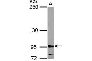 Western Blotting (WB) image for anti-Ribonucleotide Reductase M1 (RRM1) (AA 246-792) antibody (ABIN1500769) (RRM1 antibody  (AA 246-792))