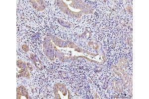 IHC analysis of Glutaminase/GLS using anti-Glutaminase/GLS antibody (ABIN7601601). (Glutaminase antibody  (AA 396-654))