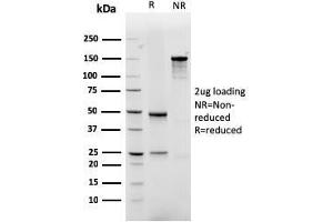 SDS-PAGE Analysis Purified GLUT-1 Recombinant Mouse Monoclonal Antibody (rGLUT1/2476). (Recombinant GLUT1 antibody  (AA 203-305))