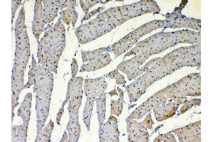 IHC analysis of Dnmt1 using anti-Dnmt1 antibody . (DNMT1 antibody  (AA 22-126))