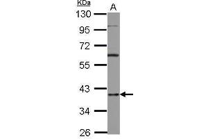 WB Image Sample (30 ug of whole cell lysate) A: A431 10% SDS PAGE antibody diluted at 1:1000